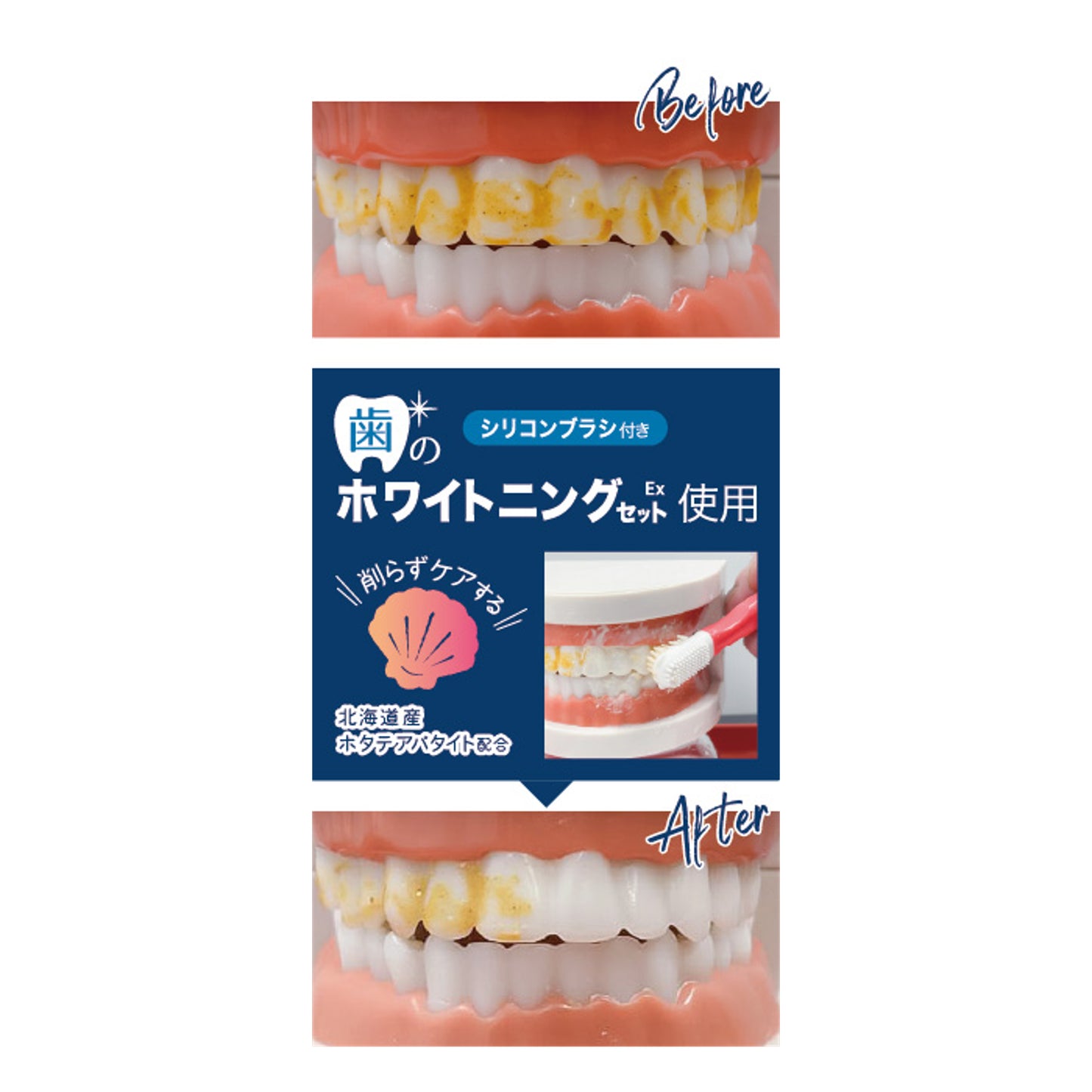 歯のホワイトニングセットEx